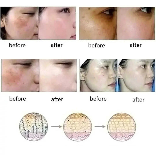 Dredge Meridian Skin Care Natural Pure Removal Acne Stretch Marks Scar Removal Essence oil 30ML - alternative view