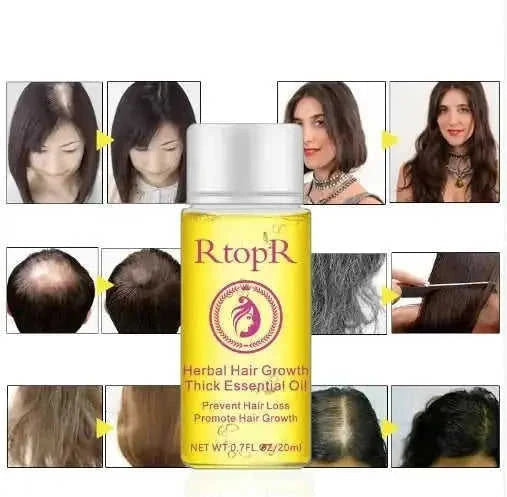 fast hair growth essential oil | hair loss prevention treatment | 20ml hair care liquid | energy saving