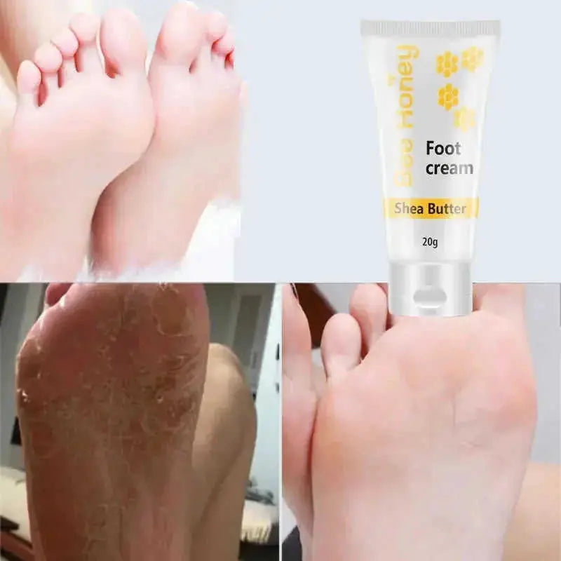 deep moisturizing foot cream | cracked heel repair cream | therapeutic foot lotion | ultrasonic cleaning