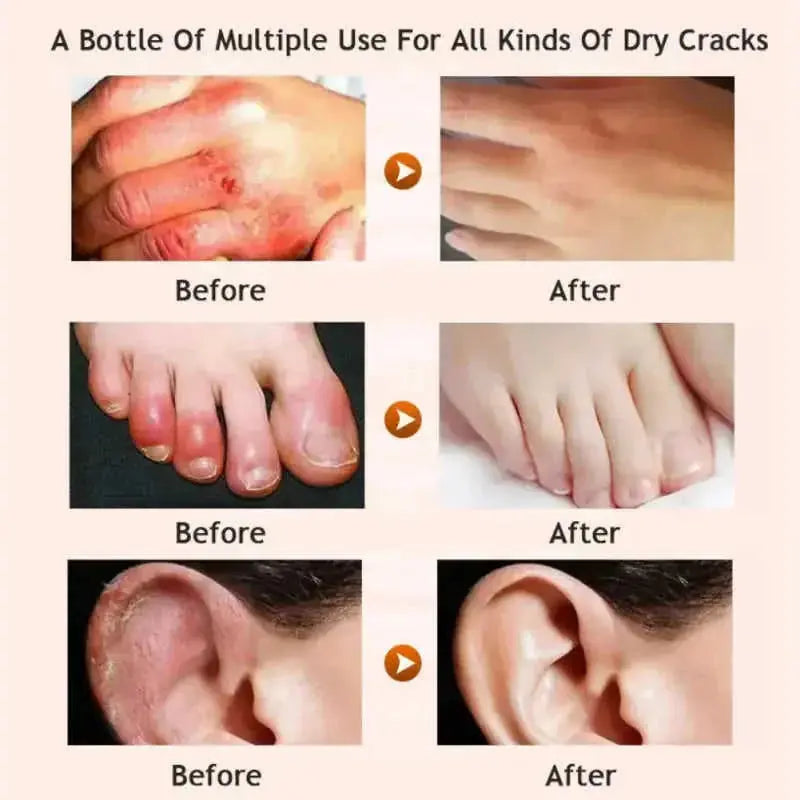 deep moisturizing foot cream | cracked heel repair cream | therapeutic foot lotion | energy saving