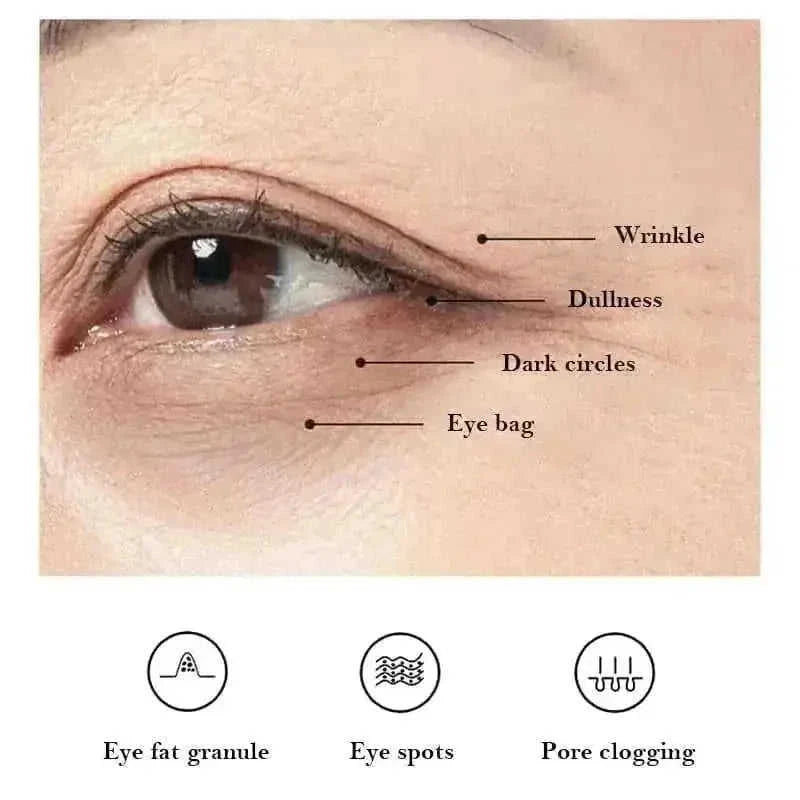 Hyaluronic Acid Eye Mask - 60Pcs Cherry Blossom Collagen Eye Patches for Dark Circles, Puffiness & Fine Lines Default Titl...