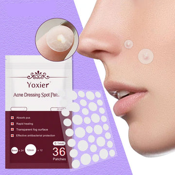invisible acne patches | hydrocolloid pimple patches | acne spot treatment stickers | ultrasonic cleaning
