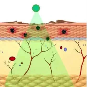 ion export import tool | skin care beauty instrument | professional facial massager | ultrasonic cleaning