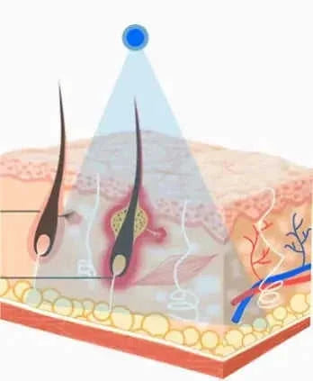 ion export import tool | skin care beauty instrument | professional facial massager | energy saving