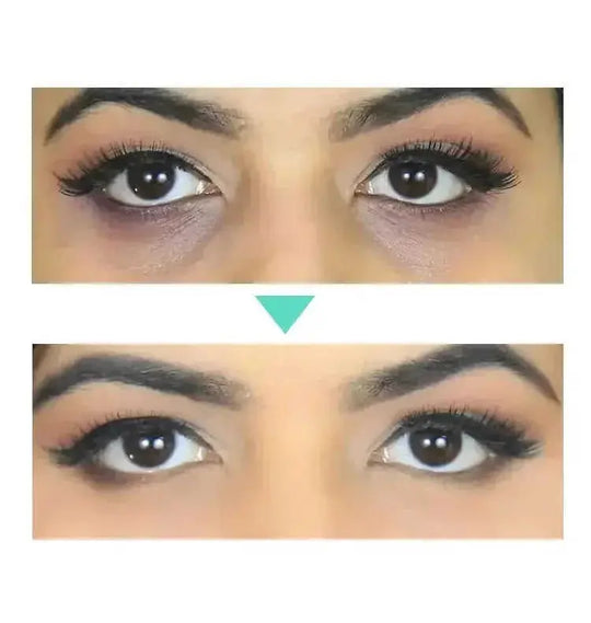 anti-aging eye cream | hyaluronic acid moisturizer | dark circle treatment | energy saving