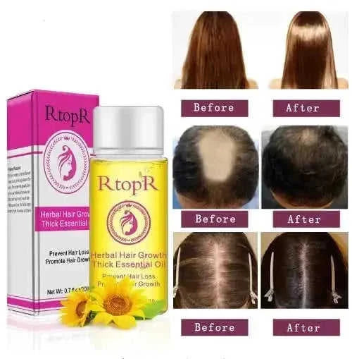 fast hair growth essential oil | hair loss prevention treatment | 20ml hair care liquid | energy saving