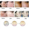 Dredge Meridian Skin Care Natural Pure Removal Acne Stretch Marks Scar Removal Essence oil 30ML - alternative view