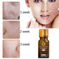 Dredge Meridian Skin Care Natural Pure Removal Acne Stretch Marks Scar Removal Essence oil Meifu Market