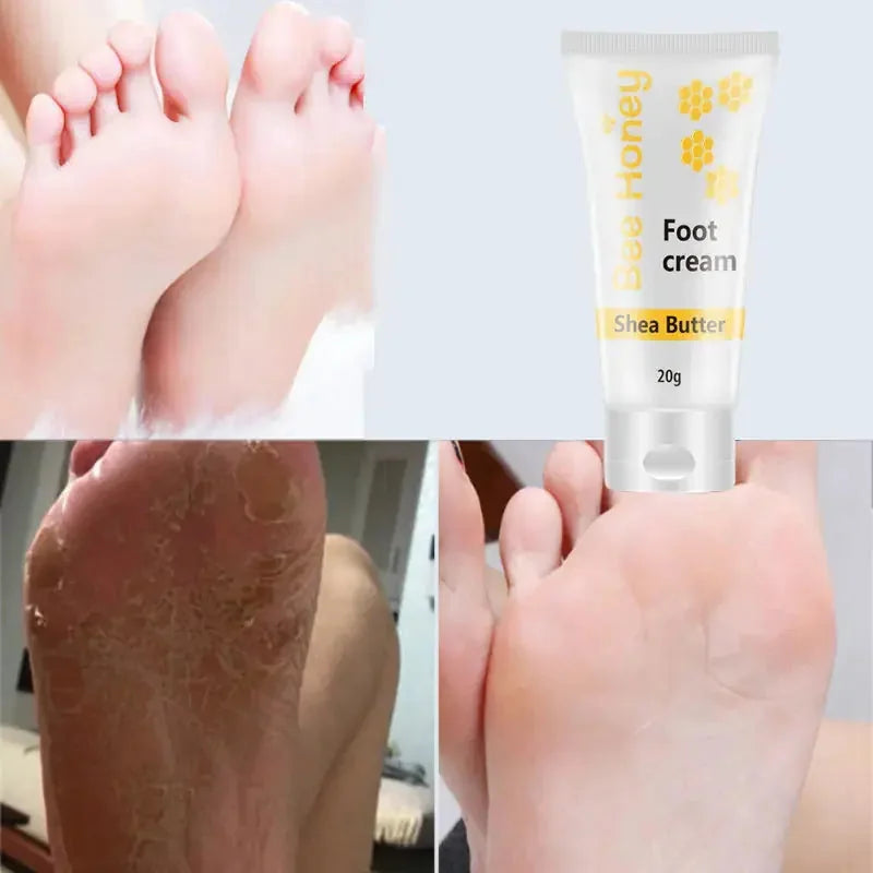 deep moisturizing foot cream | cracked heel repair cream | therapeutic foot lotion | ultrasonic cleaning