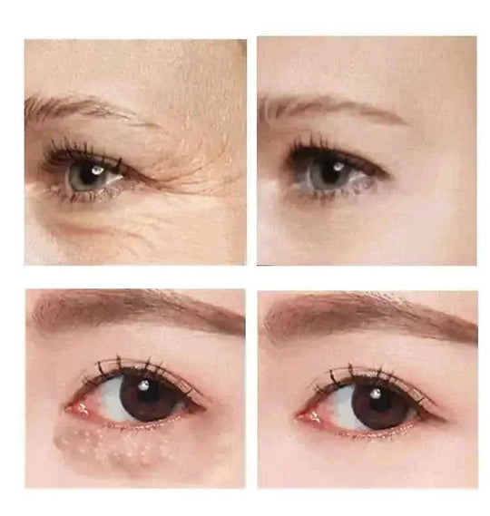 anti-aging eye cream | hyaluronic acid moisturizer | dark circle treatment | energy saving