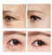 anti-aging eye cream | hyaluronic acid moisturizer | dark circle treatment | energy saving