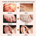 deep moisturizing foot cream | cracked heel repair cream | therapeutic foot lotion | energy saving