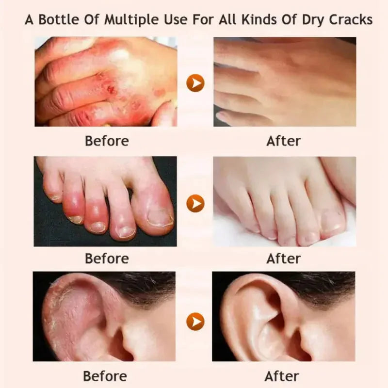 deep moisturizing foot cream | cracked heel repair cream | therapeutic foot lotion | energy saving