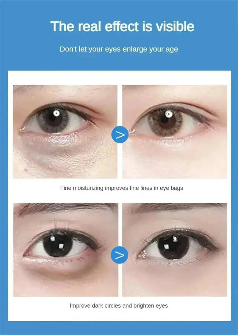 hydrating collagen eye patches | jellyfish collagen eye mask | 60 pieces eye patches | ultrasonic cleaning