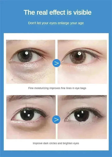 60pcs Jellyfish Collagen Eye Patch for Hydrating Dry Eye Skin