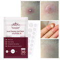 invisible acne patches | hydrocolloid pimple patches | acne spot treatment stickers | ultrasonic cleaning