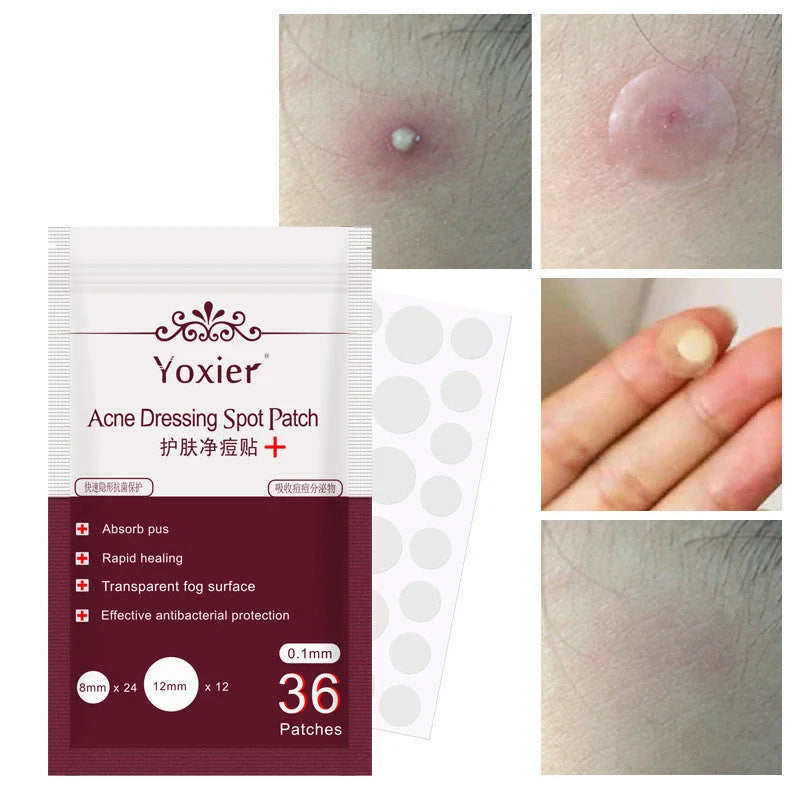 invisible acne patches | hydrocolloid pimple patches | acne spot treatment stickers | ultrasonic cleaning