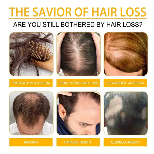 hair growth essential oil blend | natural hair repair treatment | scalp care for thinning hair | energy saving