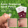 invisible acne patches | hydrocolloid pimple patches | acne spot treatment stickers | ultrasonic cleaning