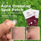 invisible acne patches | hydrocolloid pimple patches | acne spot treatment stickers | ultrasonic cleaning