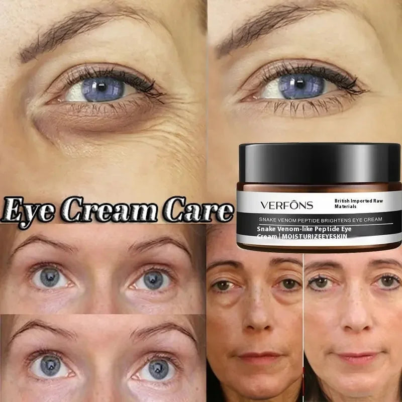 anti-aging eye cream for women | hyaluronic acid eye cream | retinol eye treatment cream | energy saving