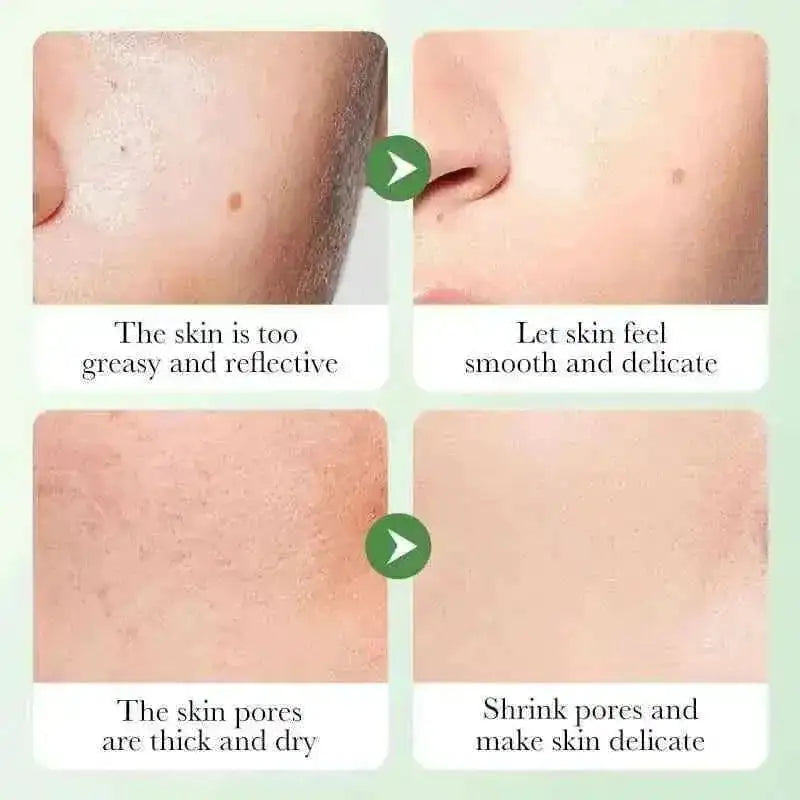 centella asiatica skincare set | sensitive skin care routine | daily hydration regimen | ultrasonic cleaning