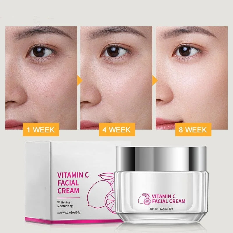 vitamin c face cream 30g | daily hydrating facial moisturizer | best vitamin c cream for dark spots | ultrasonic cleaning