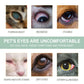 Dogs And Cats Eye Care Eye Drops Meifu Market