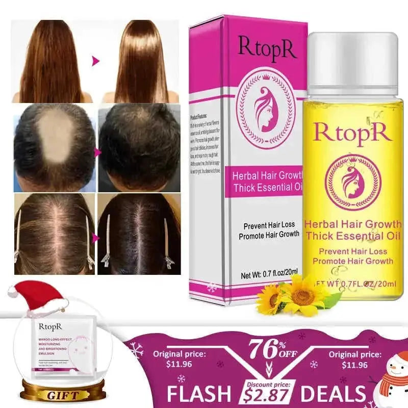 fast hair growth essential oil | hair loss prevention treatment | 20ml hair care liquid | ultrasonic cleaning