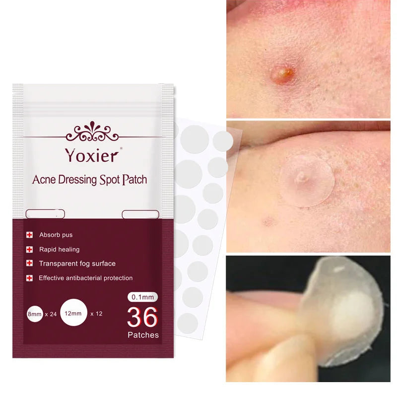 invisible acne patches | hydrocolloid pimple patches | acne spot treatment stickers | energy saving