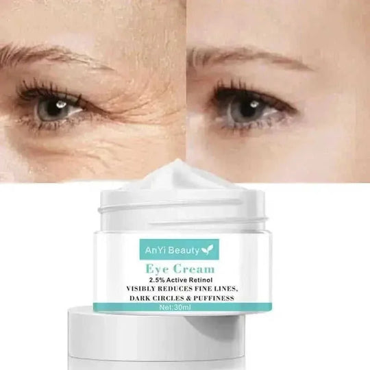 anti-aging eye cream | hyaluronic acid moisturizer | dark circle treatment | energy saving
