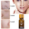 Dredge Meridian Skin Care Natural Pure Removal Acne Stretch Marks Scar Removal Essence oil 30ML - back view