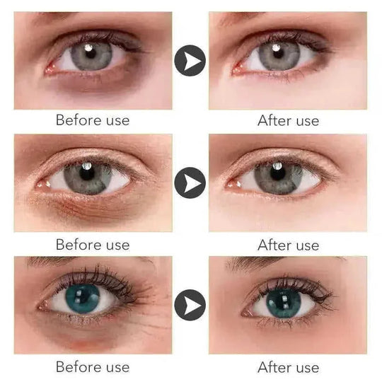 anti-aging eye cream | hyaluronic acid moisturizer | dark circle treatment | energy saving